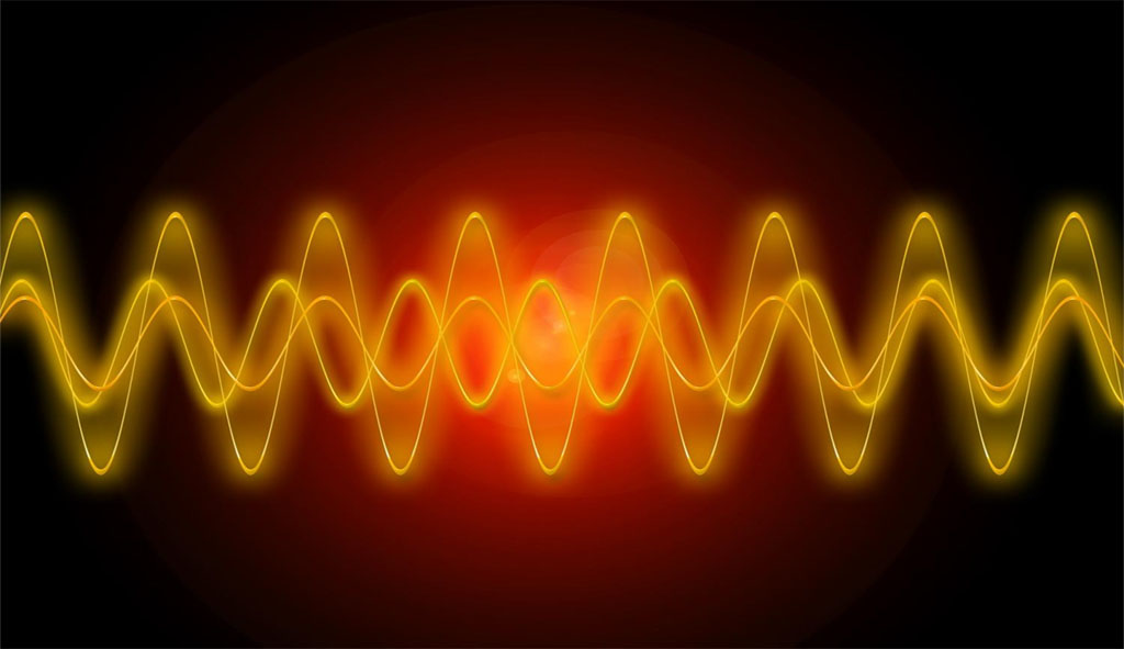 Frequencies